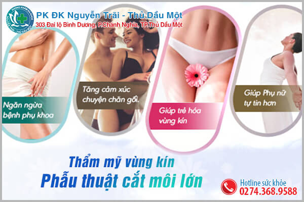 Phẫu thuật cắt môi lớn tại Đa khoa Thủ Dầu Một - Bí quyết giữ lửa tình yêu của chị em