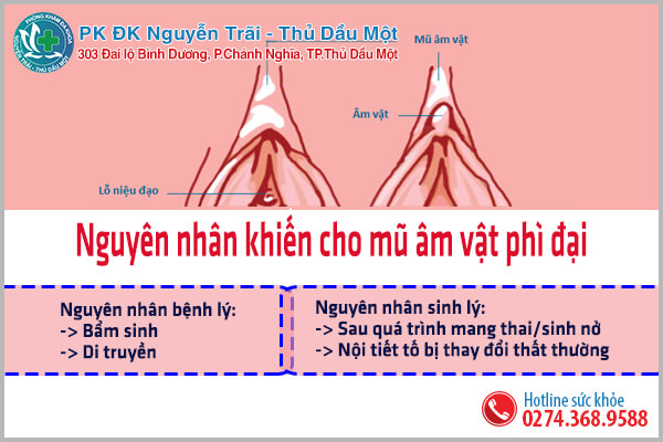 Tạo hình, chỉnh mũ âm vật - Phục hồi sinh lý, thăng hoa cảm xúc yêu