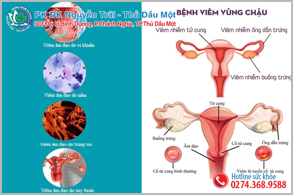 Những bệnh lý gây ra tình trạng khí hư có mùi tanh