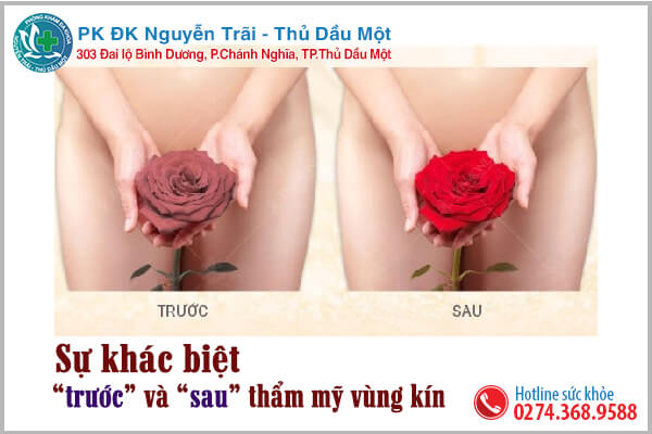 Tuyệt chiêu làm hồng vùng kín, đẹp tự nhiên